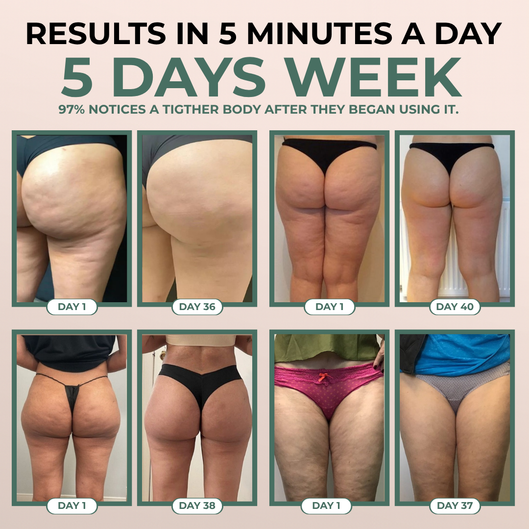 Noruxe™ Cellulite Relief Massager