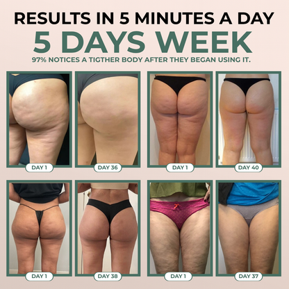 Noruxe™ Cellulite Relief Massager